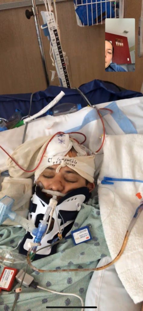Photo of the victim of a hit-and-run in Miami in the hospital